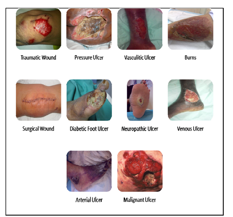 Merawat luka di rumah